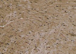 Phospho-EZH2 (Thr487) Polyclonal Antibody:Antibodies, Polyclonal