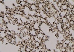 Phospho-EZH2 (Thr487) Polyclonal Antibody:Antibodies, Polyclonal