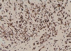 Invitrogen Phospho-PKN2 (Ser815) Polyclonal Antibody 100 &mu;L; Unconjugated:Antibodies,