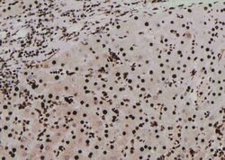 Invitrogen Phospho-PKN2 (Ser815) Polyclonal Antibody 100 &mu;L; Unconjugated:Antibodies,