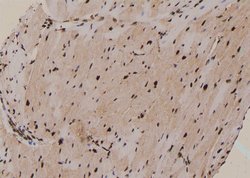 Invitrogen Phospho-PKN2 (Ser815) Polyclonal Antibody 100 &mu;L; Unconjugated:Antibodies,