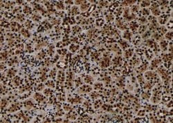 Invitrogen Phospho-PKN2 (Ser815) Polyclonal Antibody 100 &mu;L; Unconjugated:Antibodies,
