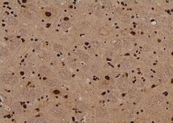 Invitrogen Phospho-PKN2 (Ser815) Polyclonal Antibody 100 &mu;L; Unconjugated:Antibodies,