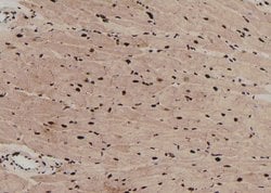 Invitrogen Phospho-PKN2 (Ser815) Polyclonal Antibody 100 &mu;L; Unconjugated:Antibodies,