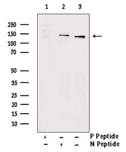 Invitrogen Phospho-PKN2 (Ser815) Polyclonal Antibody 100 &mu;L; Unconjugated:Antibodies,