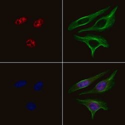 Invitrogen Phospho-ERK3 (Ser189) Polyclonal Antibody 100 &mu;L; Unconjugated:Antibodies,