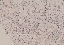 Invitrogen Phospho-ERK3 (Ser189) Polyclonal Antibody 100 &mu;L; Unconjugated:Antibodies,