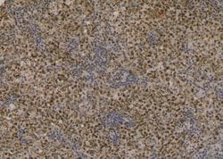 Invitrogen Phospho-ERK3 (Ser189) Polyclonal Antibody 100 &mu;L; Unconjugated:Antibodies,