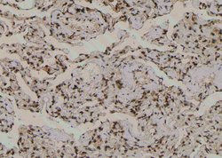 Invitrogen Phospho-TBC1D1 (Ser627) Polyclonal Antibody 100 &mu;L; Unconjugated:Antibodies,