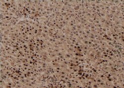 Invitrogen Phospho-TBC1D1 (Ser627) Polyclonal Antibody 100 &mu;L; Unconjugated:Antibodies,