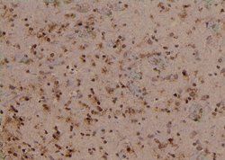 Invitrogen Phospho-TBC1D1 (Ser627) Polyclonal Antibody 100 &mu;L; Unconjugated:Antibodies,