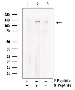 Invitrogen Phospho-TBC1D1 (Ser627) Polyclonal Antibody 100 &mu;L; Unconjugated:Antibodies,
