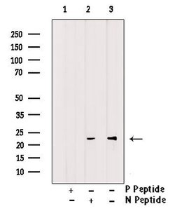 Invitrogen Phospho-FADD (Ser41) Polyclonal Antibody 100 μL; Unconjugated:Antibodies,