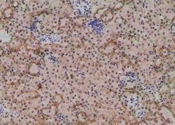 Invitrogen Phospho-RICTOR (Ser1591) Polyclonal Antibody 100 &mu;L; Unconjugated:Antibodies,