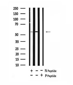 Invitrogen Phospho-ATG14 (Thr429) Polyclonal Antibody 100 &mu;L; Unconjugated:Antibodies,