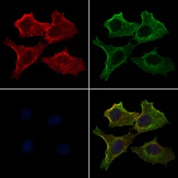 Invitrogen Phospho-MOB4A (Tyr26) Polyclonal Antibody 100 &mu;L; Unconjugated:Antibodies,