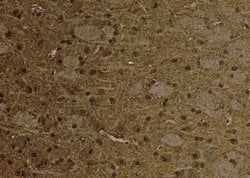 Invitrogen Phospho-STING (Ser366) Polyclonal Antibody 100 &mu;L; Unconjugated:Antibodies,