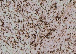 Invitrogen Phospho-MLKL (Ser125) Polyclonal Antibody 100 &mu;L; Unconjugated:Antibodies,