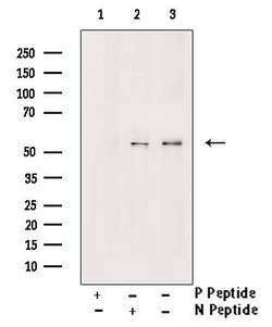 Invitrogen Phospho-MLKL (Ser125) Polyclonal Antibody 100 &mu;L; Unconjugated:Antibodies,