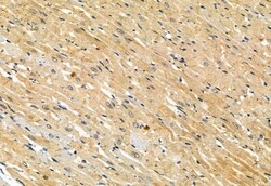 Invitrogen Phospho-MLKL (Ser358) Polyclonal Antibody 100 &mu;L; Unconjugated:Antibodies,