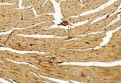 Invitrogen Phospho-MLKL (Ser358) Polyclonal Antibody 100 &mu;L; Unconjugated:Antibodies,
