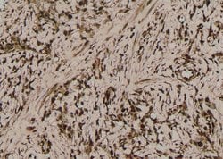 Invitrogen Phospho-MLKL (Ser358) Polyclonal Antibody 100 &mu;L; Unconjugated:Antibodies,