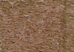 Invitrogen Phospho-MLKL (Ser358) Polyclonal Antibody 100 &mu;L; Unconjugated:Antibodies,