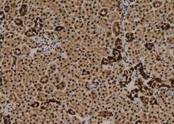 Invitrogen Phospho-VPS34 (Ser244, Ser249) Polyclonal Antibody 100 &mu;L;