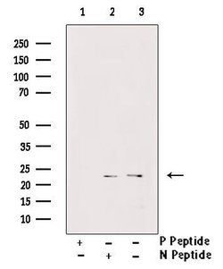 Invitrogen Phospho-LIN28A (Ser200) Polyclonal Antibody 100 &mu;L; Unconjugated:Antibodies,
