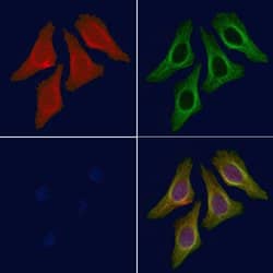 Phospho-LATS2 (Ser380) Polyclonal Antibody, Invitrogen&trade;