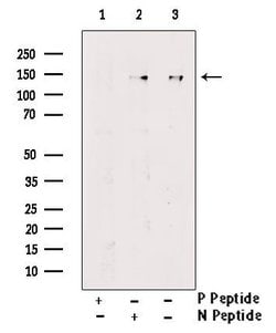 Phospho-LATS2 (Ser380) Polyclonal Antibody, Invitrogen&trade;