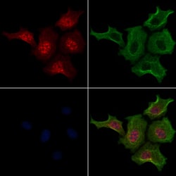 Invitrogen Phospho-LATS2 (Ser872) Polyclonal Antibody 100 μL; Unconjugated:Antibodies,