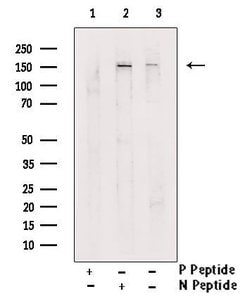 Invitrogen Phospho-LATS2 (Ser872) Polyclonal Antibody 100 μL; Unconjugated:Antibodies,