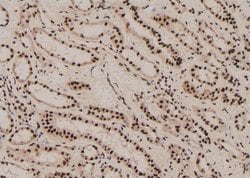 Invitrogen Phospho-GLI3 (Ser664) Polyclonal Antibody 100 μL; Unconjugated:Antibodies,