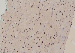 Invitrogen Phospho-GLI3 (Ser664) Polyclonal Antibody 100 μL; Unconjugated:Antibodies,
