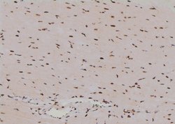 Invitrogen Phospho-GLI3 (Ser664) Polyclonal Antibody 100 μL; Unconjugated:Antibodies,