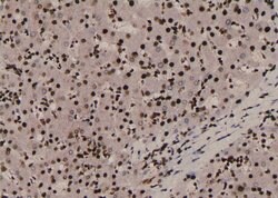 Invitrogen Phospho-SOX2 (Ser249, Ser250) Polyclonal Antibody 100 μL;