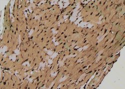 Invitrogen Phospho-SOX2 (Ser249, Ser250) Polyclonal Antibody 100 μL;