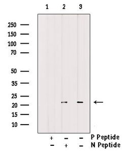 Invitrogen Phospho-Claudin 7 (Tyr210) Polyclonal Antibody 100 &mu;L; Unconjugated:Antibodies,