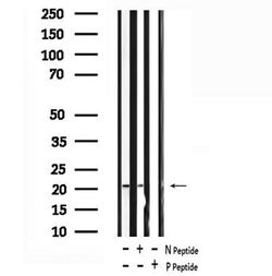Invitrogen Phospho-Claudin 7 (Tyr210) Polyclonal Antibody 100 &mu;L; Unconjugated:Antibodies,