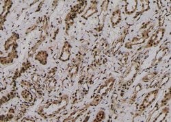 Invitrogen Phospho-RyR2 (Ser2808) Polyclonal Antibody 100 &mu;L; Unconjugated:Antibodies,