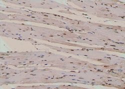 Invitrogen Phospho-RyR2 (Ser2808) Polyclonal Antibody 100 &mu;L; Unconjugated:Antibodies,