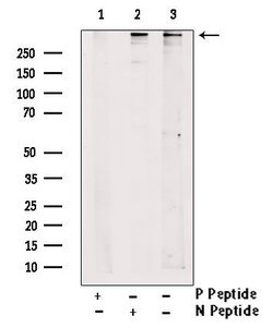 Invitrogen Phospho-RyR2 (Ser2808) Polyclonal Antibody 100 &mu;L; Unconjugated:Antibodies,