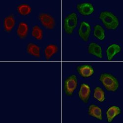 Invitrogen SLC22A8 Polyclonal Antibody 100 &mu;L; Unconjugated:Antibodies,