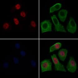 Invitrogen SETD8 Polyclonal Antibody 100 &mu;L; Unconjugated:Antibodies,