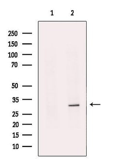 Invitrogen MPZL1 Polyclonal Antibody 100 &mu;L | Buy Online | Invitrogen&trade; | Fisher Scientific