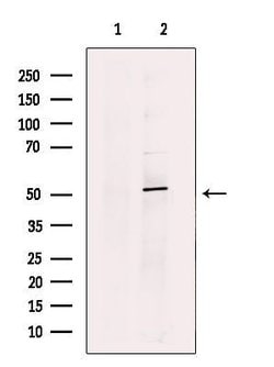 Invitrogen CTDSPL2 Polyclonal Antibody 100 μL; Unconjugated:Antibodies,