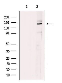 Invitrogen TBC1D1 Polyclonal Antibody 100 μL; Unconjugated:Antibodies,