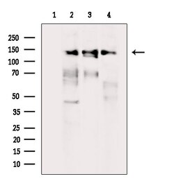 Invitrogen TBC1D1 Polyclonal Antibody 100 μL; Unconjugated:Antibodies,