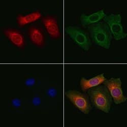 Invitrogen MAPK15 Polyclonal Antibody 100 &mu;L; Unconjugated:Antibodies,